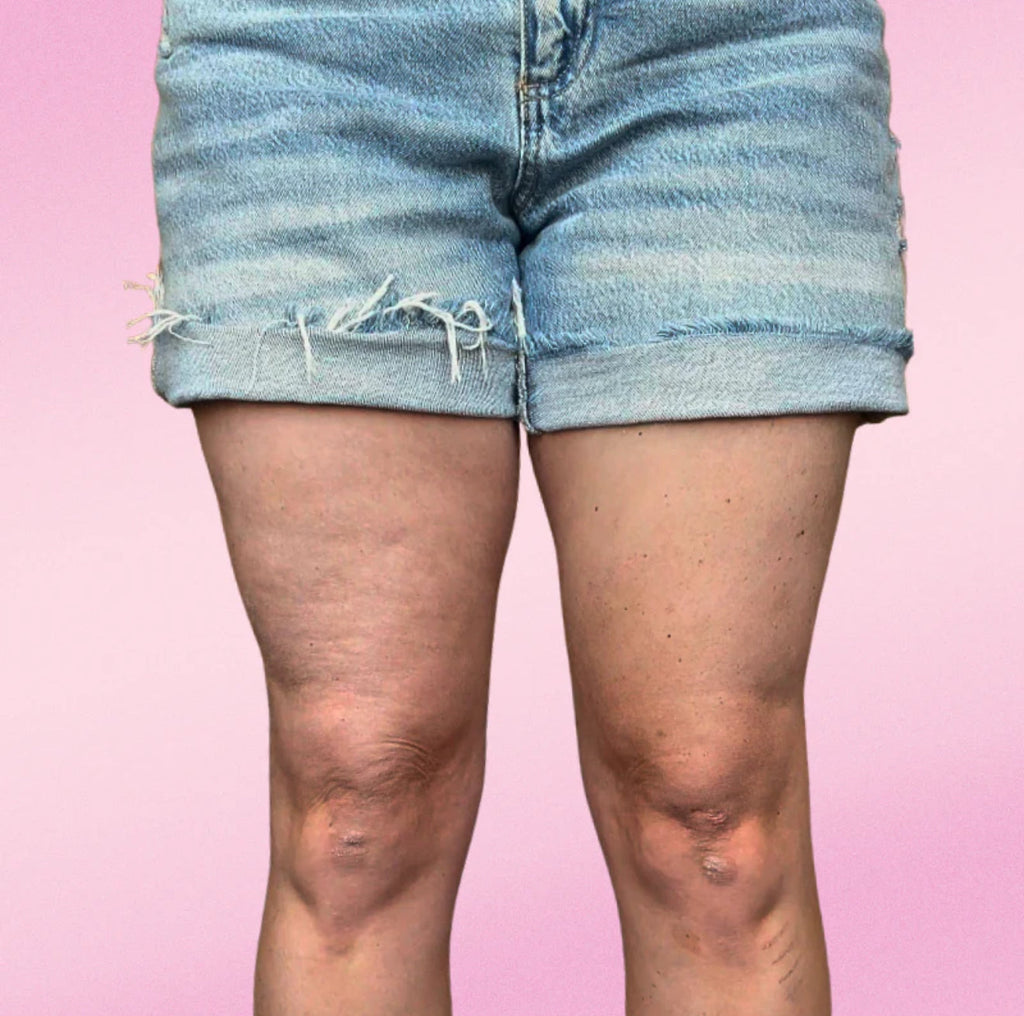 Instalif pack 10 unidades